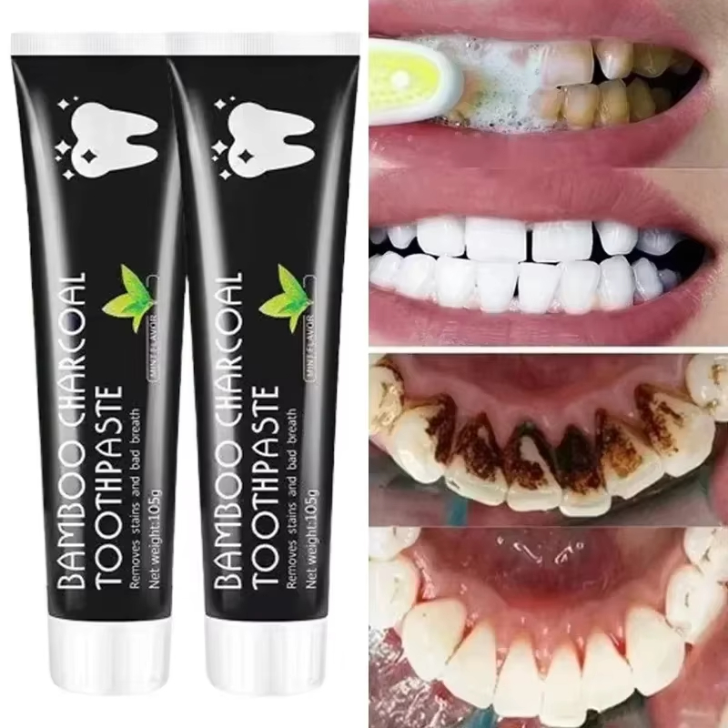 Teeth Whitening Charcoal - Pasta de dientes blanqueadora, pasta de