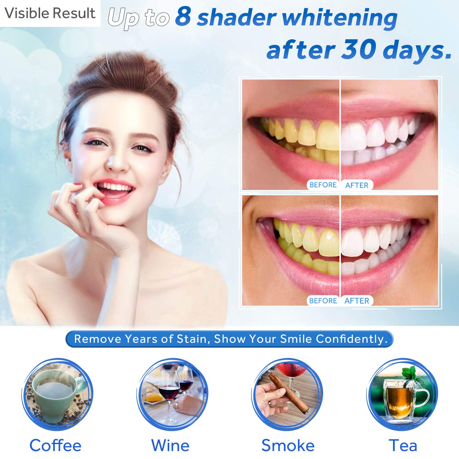 Jeringa de repuesto de Gel par - Teeth Whitening Laser reseña y precio