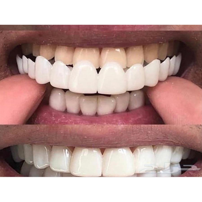 Gel de silicona suave para den - Teeth Whitening Moulds reseña y precio