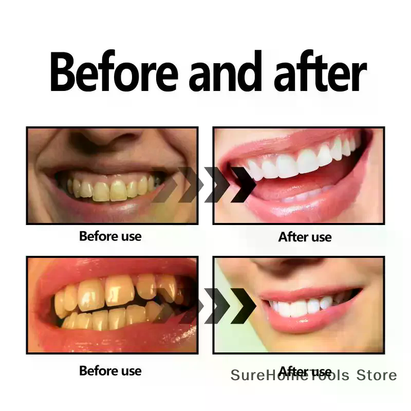 Polvo de carbón de bambú para  - Teeth Whitening Charcoal reseña y precio