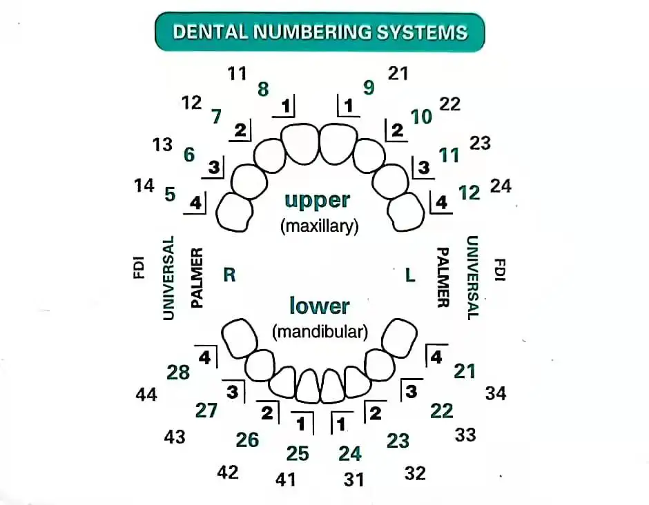 Molde Dental para carillas de  - Teeth Whitening Moulds reseña y precio